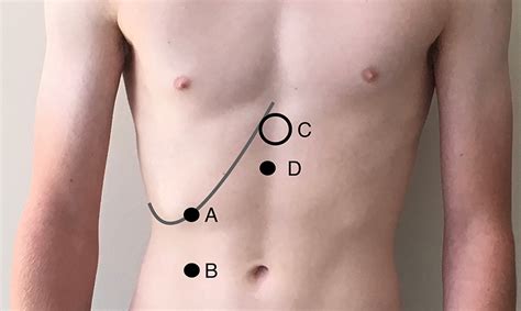 scratch test liver video|can you palpate the liver.